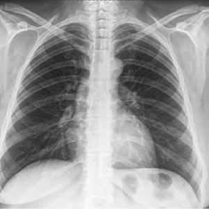 Taller virtual de Radiografía de torax